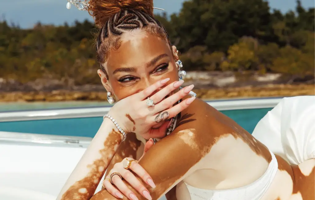 Winnie Harlow - Kyle Kuzma engagement